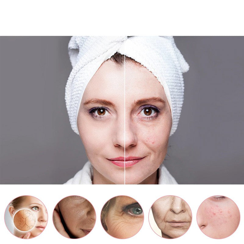 Aparat masaj facial cu ultrasunet 5 in 1 fototerapie antirid ecran lcd reincarcabil 750mah
